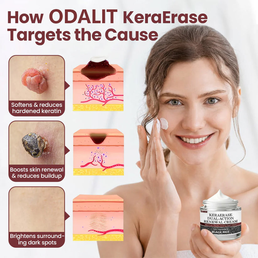 ✅Flash εκπτώσεις - Κρέμα αναγέννησης ODALIT®KeraErase με διπλή δράση